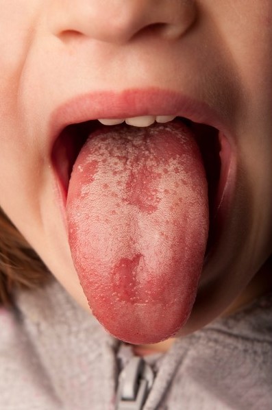 Diagnostika z jazyka - cestouprirody.eu